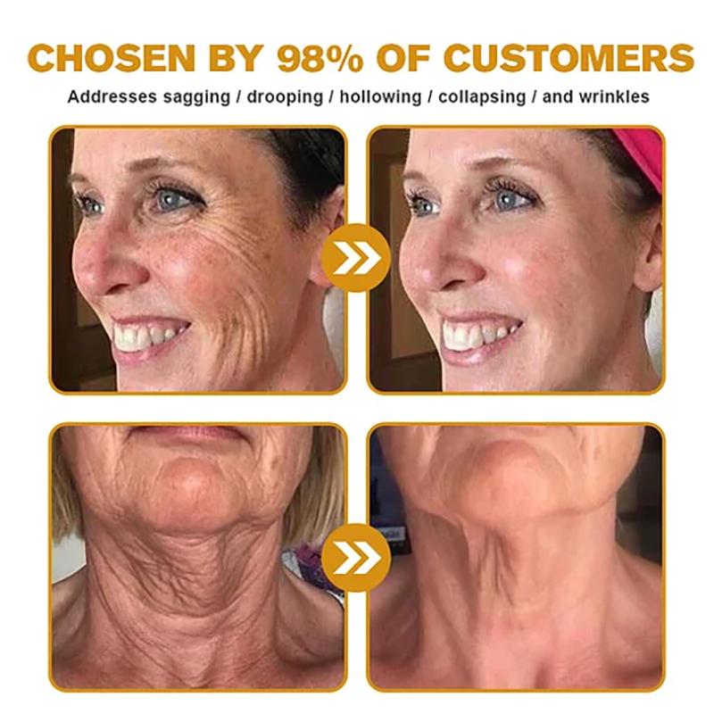Botox Bee Venom Wrinkle Removal Cream