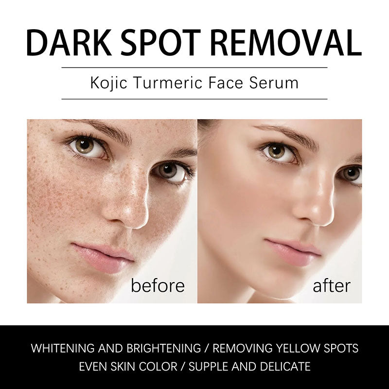 KOJIC TURMERIC FACE SERUM