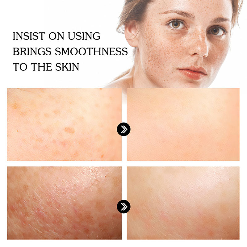 KOJIC TURMERIC FACE SERUM