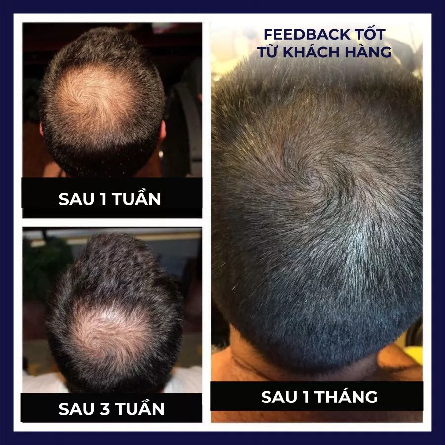 FEG PLUS HAIR SPRAY