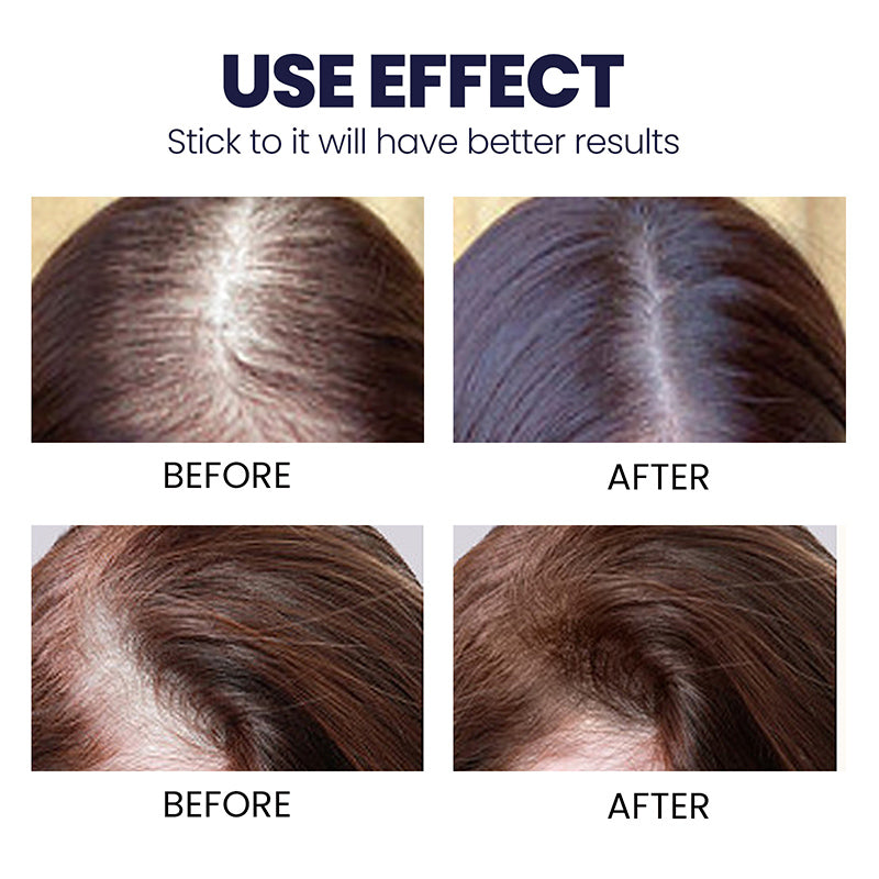 Hair growth spray