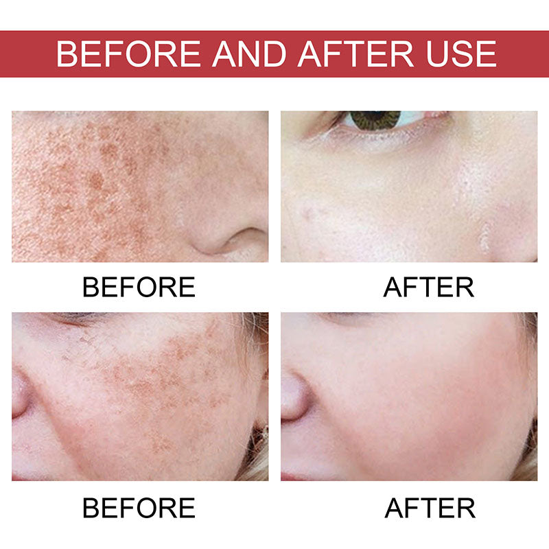 VitaGlow Hoygi Serum