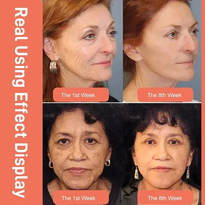 Dragon blood facial cream