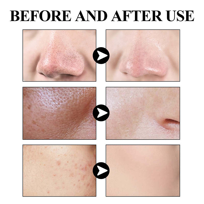 Green Tea Deep Cleanse Mask™