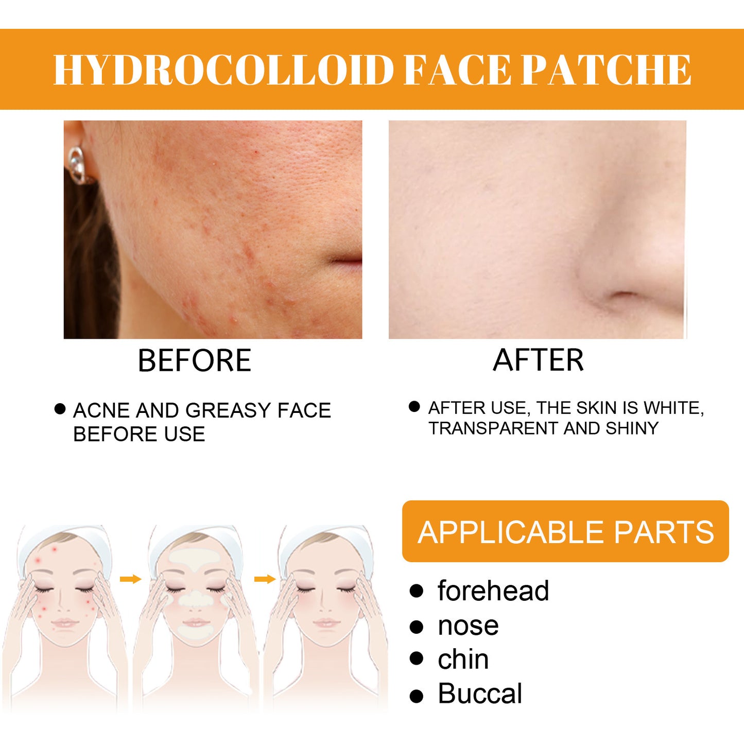 The nose acne patch