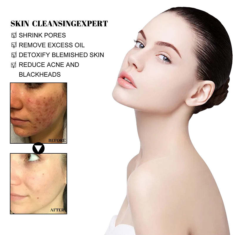 Green Tea Deep Cleanse Mask™
