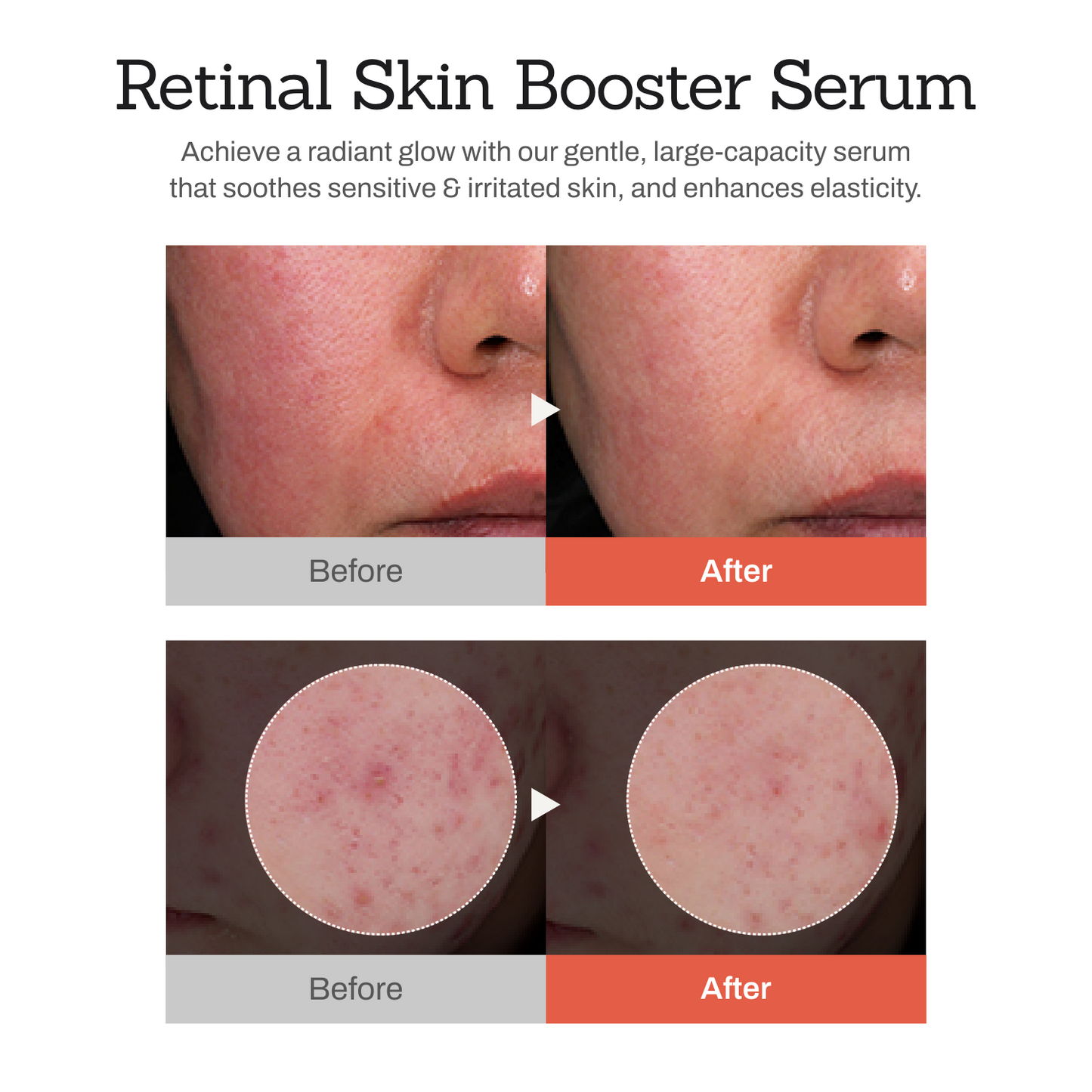 Moisturizing and Rejuvenating Essence