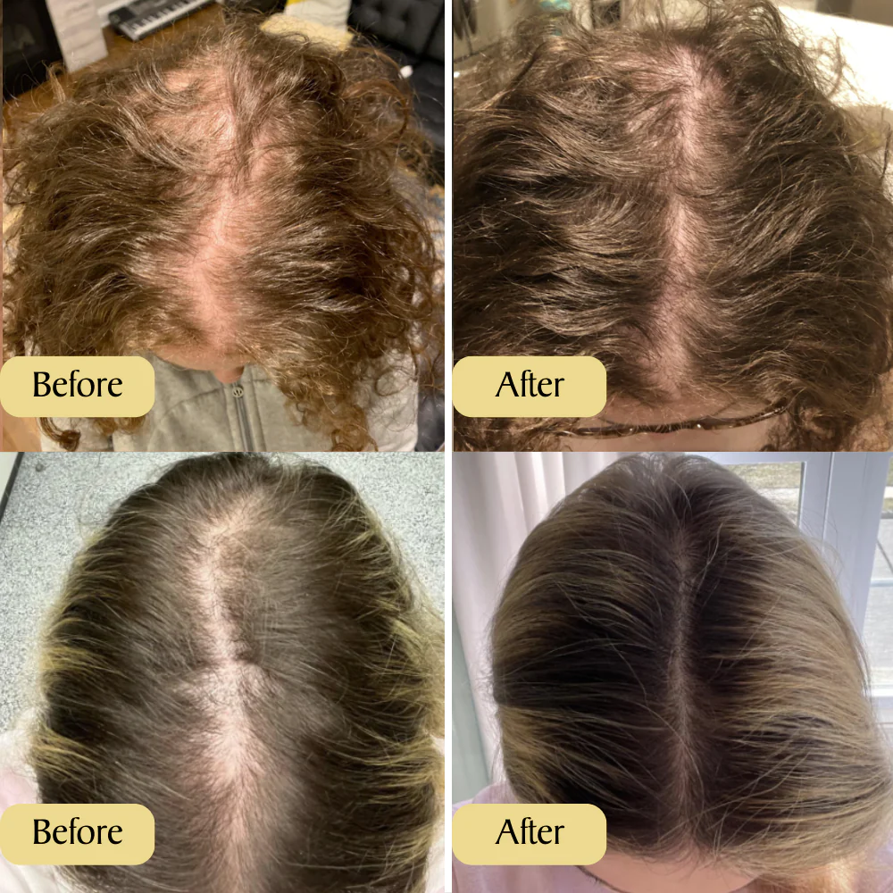 PHAIVEIA Natural Hair Growth Oil