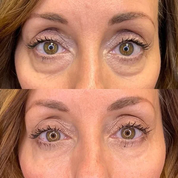 AUQUEST™ INSTANT AGELESS CREAM