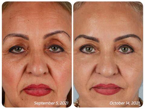 AUQUEST™ INSTANT AGELESS CREAM