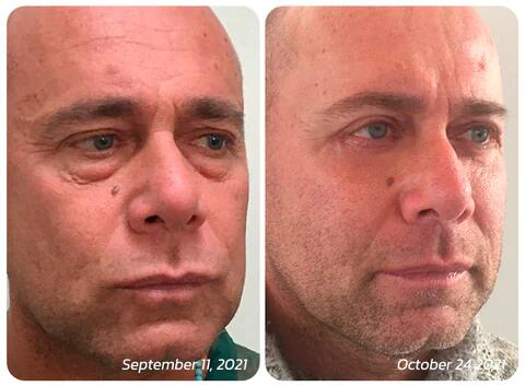 AUQUEST™ INSTANT AGELESS CREAM