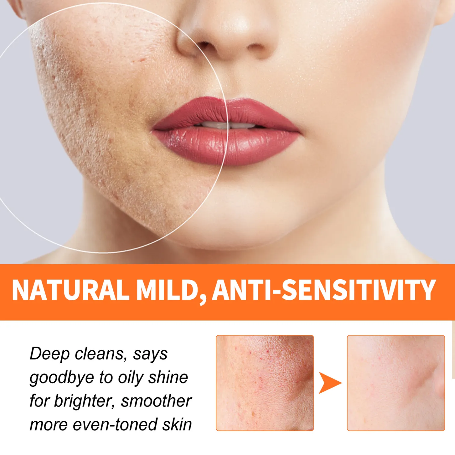 HOT SALE Magical Carrot Bubble Mask