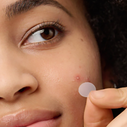 The nighttime acne patch