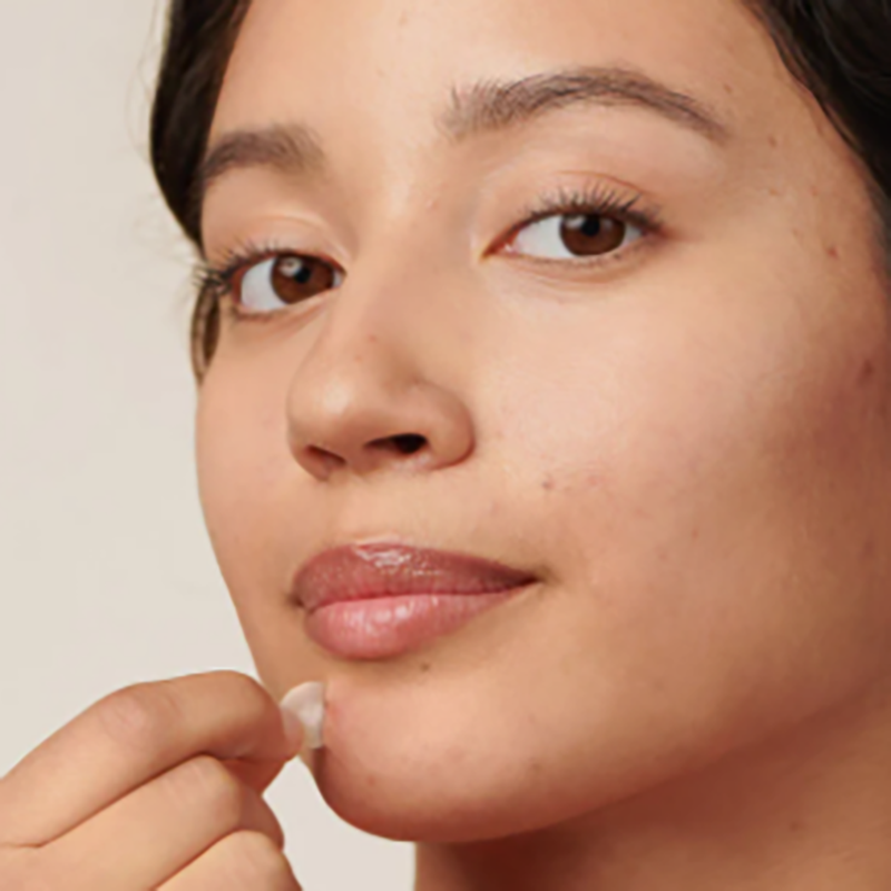 The nighttime acne patch