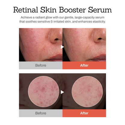 Moisturizing and Rejuvenating Essence